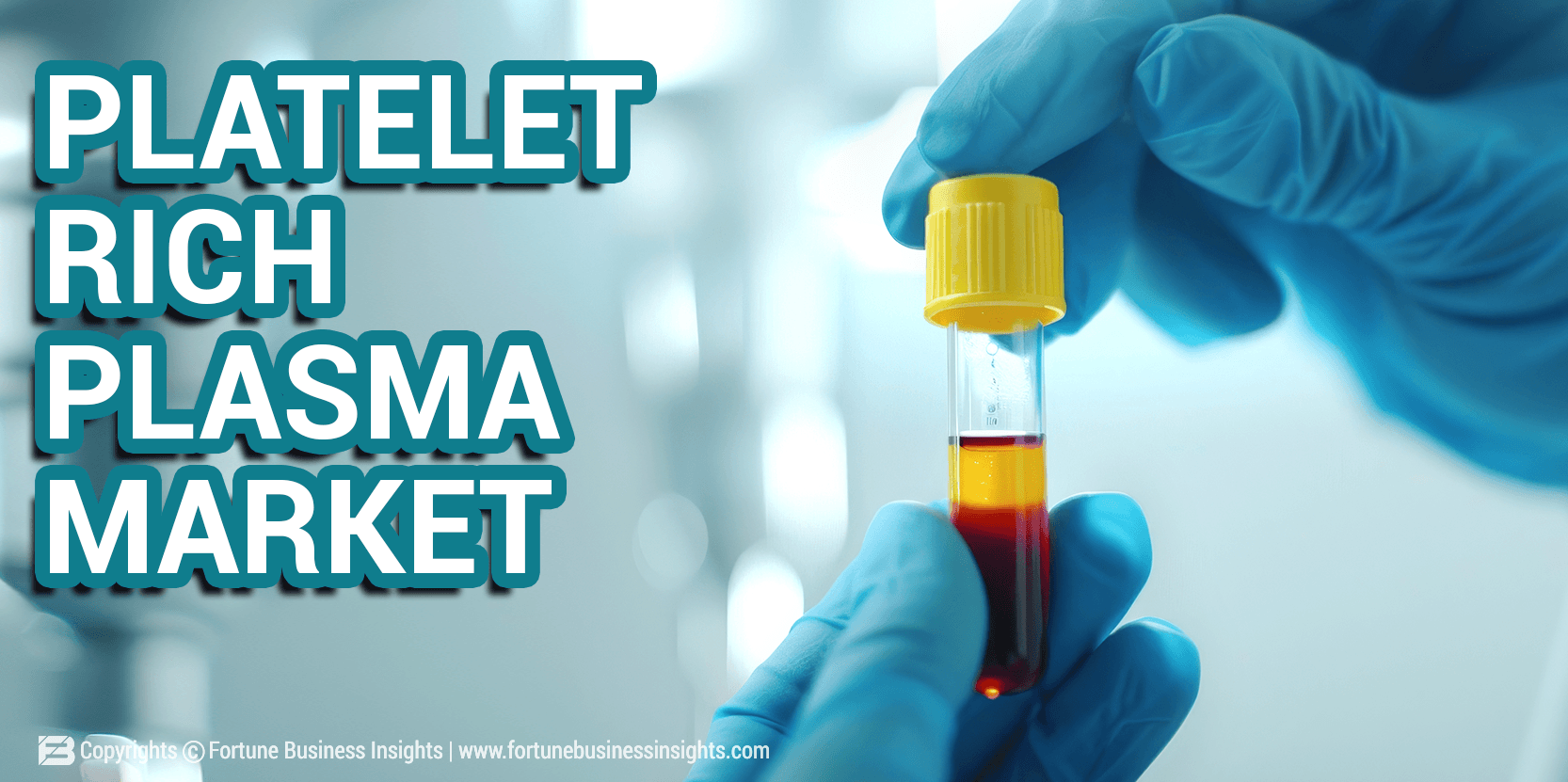 blog cover image